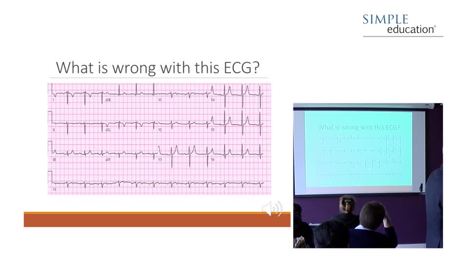 Wondr Medical Interesting Ecg Clinical Cases And Worked Examples